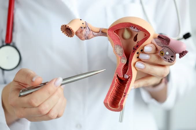 Endometriosis Surgery